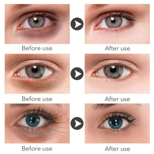 Anti Dark Circle Eye Serum Oil Retinol anti Wrinkle Firming Skin Remove Eye Bag Fade Fine Line Whitening Brighten Eye Care Korea